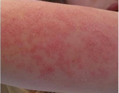 48cdd8adbf96423d8669c3fc0fa2adf9_th 48cdd8adbf96423d8669c3fc0fa2adf9_th